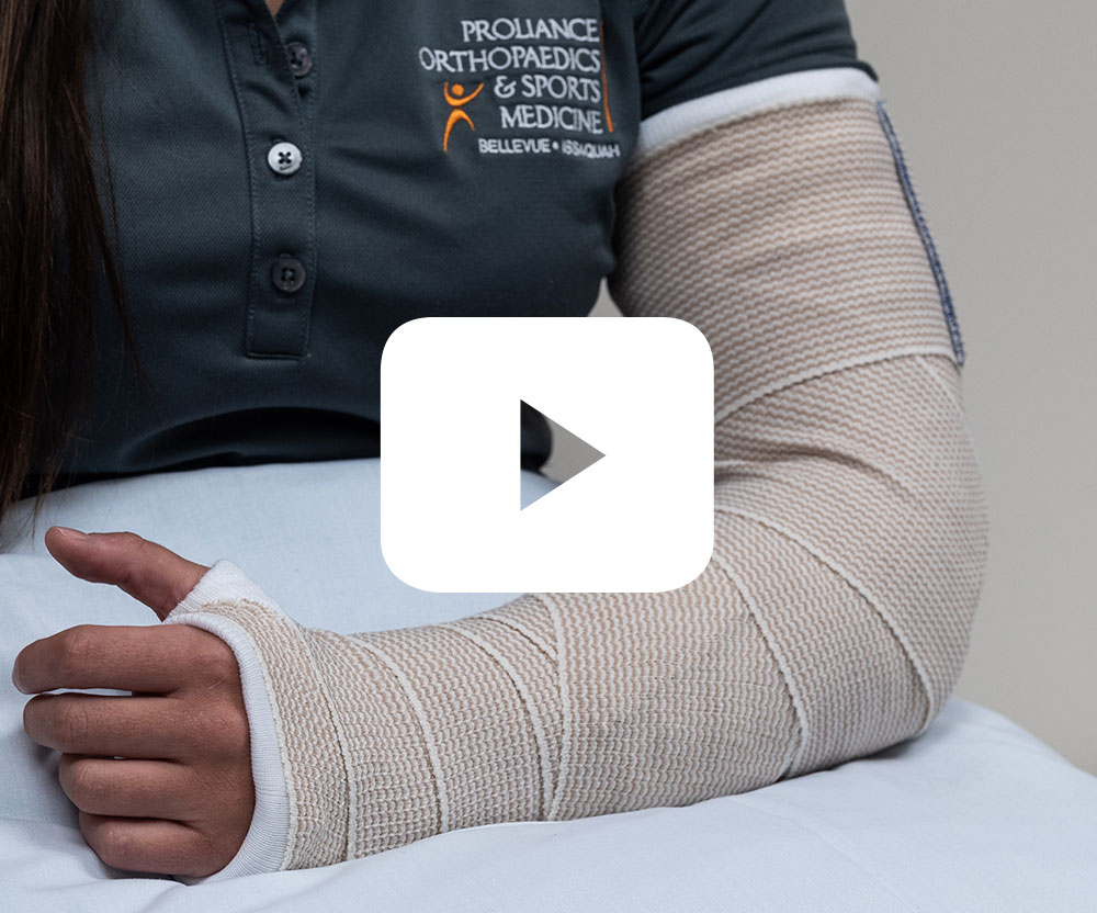 physician-splinting-guide-proliance-orthopaedics-sports-medicine